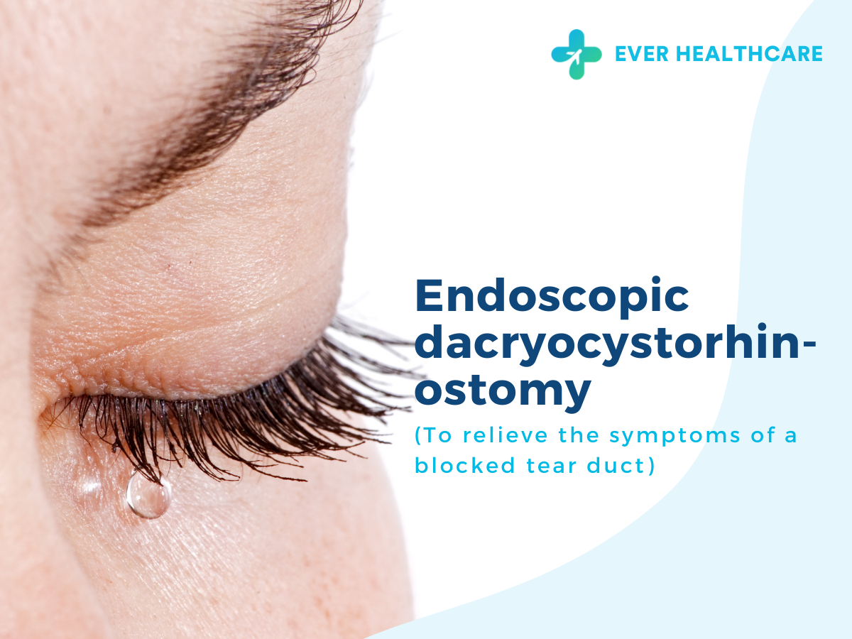 Endoscopic Dacryocystorhinostomy in Thailand 2023 Compare Price